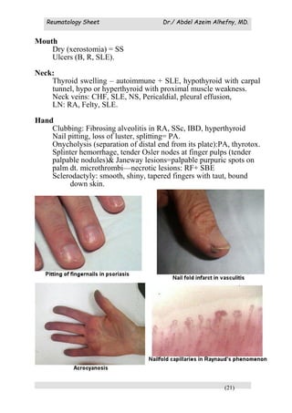 Reumatology Sheet Dr./ Abdel Azeim Alhefny, MD.
(21)
Mouth
Dry (xerostomia) = SS
Ulcers (B, R, SLE).
Neck:
Thyroid swelling – autoimmune + SLE, hypothyroid with carpal
tunnel, hypo or hyperthyroid with proximal muscle weakness.
Neck veins: CHF, SLE, NS, Pericaldial, pleural effusion,
LN: RA, Felty, SLE.
Hand
Clubbing: Fibrosing alveolitis in RA, SSc, IBD, hyperthyroid
Nail pitting, loss of luster, splitting= PA.
Onycholysis (separation of distal end from its plate):PA, thyrotox.
Splinter hemorrhage, tender Osler nodes at finger pulps (tender
palpable nodules)& Janeway lesions=palpable purpuric spots on
palm dt. microthrombi—necrotic lesions: RF+ SBE
Sclerodactyly: smooth, shiny, tapered fingers with taut, bound
down skin.
Palmar erythema: RA
 