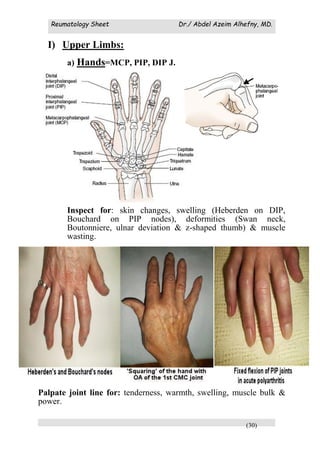 Reumatology Sheet Dr./ Abdel Azeim Alhefny, MD.
(30)
I) Upper Limbs:
a) Hands=MCP, PIP, DIP J.
Inspect for: skin changes, swelling (Heberden on DIP,
Bouchard on PIP nodes), deformities (Swan neck,
Boutonniere, ulnar deviation & z-shaped thumb) & muscle
wasting.
Palpate joint line for: tenderness, warmth, swelling, muscle bulk &
power.
 