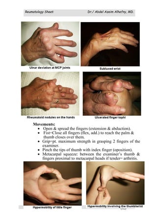 Reumatology Sheet Dr./ Abdel Azeim Alhefny, MD.
(32)
Movements:
 Open & spread the fingers (extension & abduction).
 Fist=Close all fingers (flex, add.) to reach the palm &
thumb closes over them.
 Grip=pt. maximum strength in grasping 2 fingers of the
examiner.
 Pinch the tips of thumb with index finger (oposition).
 Metacarpal squeeze: between the examiner’s thumb &
fingers proximal to metacarpal heads if tender= arthritis.
 