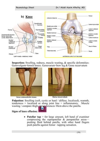Reumatology Sheet Dr./ Abdel Azeim Alhefny, MD.
(39)
b) Knee
Inspection: Swelling, redness, muscle wasting, & specific deformities:
Genovulgum=knock knees. Genuvarum=bow leg.& Genu recurvatum
Palpation: Swelling (soft, cystic or hard / diffuse, localized), warmth,
tenderness = localized or along joint line = inflammatory. Muscle
wasting / compare thigh circumferences 10cm above the patella.
Signs of knee effusion:
 Patellar tap = for large amount, left hand of examiner
compressing the suprapatellar & parapatellar areas—
pushing fluid behind patella, with other hand fingers
push patella against femur –tapping sensation.
 