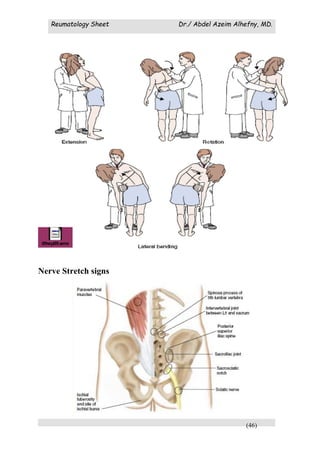 Reumatology Sheet Dr./ Abdel Azeim Alhefny, MD.
(46)
Nerve Stretch signs
 