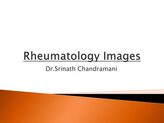 Dr.Srinath Chandramani
 