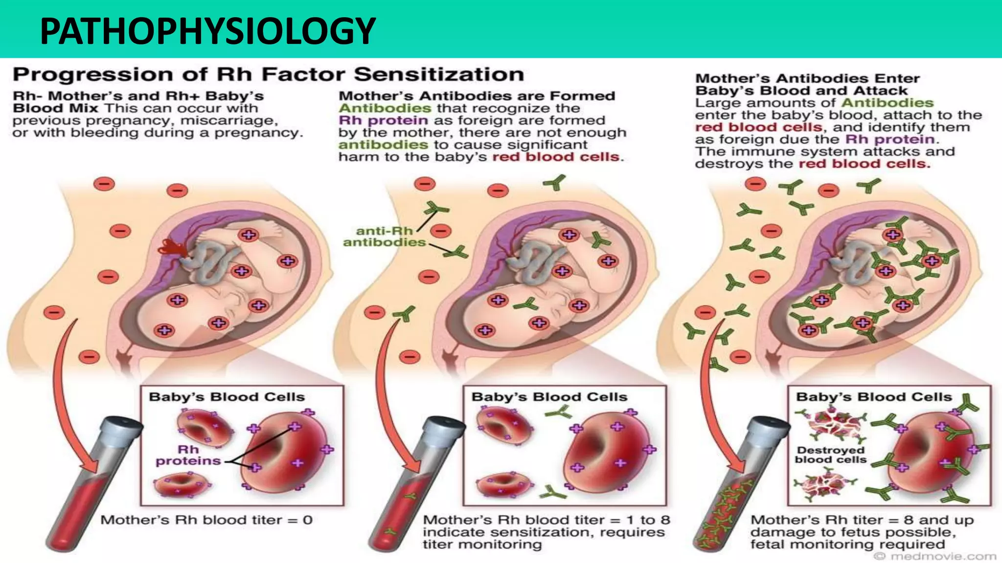 PATHOPHYSIOLOGY
 