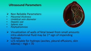  Non Reliable Parameters:
• Placental thickness
• Umbilical vein diameter
• Hepatic size
• Splenic size
• Polyhydramnios
 Visualization of walls of fetal bowel from small amounts
intra abdominal fluid may be 1st sign of impending
hydrops
 U/S reliable for hydrops (ascites, pleural effusions, skin
edema) – Hgb < 70
Ultrasound Parameters
 
