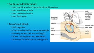 • Routes of administration-
• Into umbilical vein at the point of cord insertion
• Into intrahepatic vein
• Into peritoneal cavity
• Into fetal heart
• Transfused blood-
• RhD negative
• Crossmatched with a maternal sample
• Densely packed (Hb around 30g/L)
• White cell depleted and irradiated
• Screened for infection including CMV
 