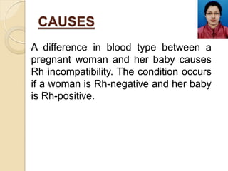 CAUSES
A difference in blood type between a
pregnant woman and her baby causes
Rh incompatibility. The condition occurs
if...