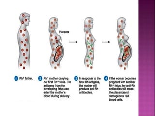 Incompability Rhesus Rh incompatibility | PPTX