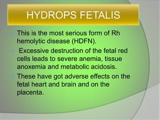 HYDROPS FETALIS
 This is the most serious form of Rh
hemolytic disease (HDFN).
 Excessive destruction of the fetal red
cells leads to severe anemia, tissue
anoxemia and metabolic acidosis.
 These have got adverse effects on the
fetal heart and brain and on the
placenta.
 