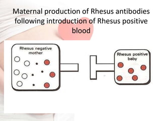 Incompability Rhesus Rh Incompatibility a Gynecological disorder | PPT
