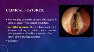CLINICAL FEATURES:
• Patient may complain of nasal obstruction in
spite of unduly wide nasal chambers.
• merciful anosmia:There is foul smell from
the nose making the patient a social outcast
though patient himself is unaware of the
smell due to marked anosmia
• Epistaxis
 