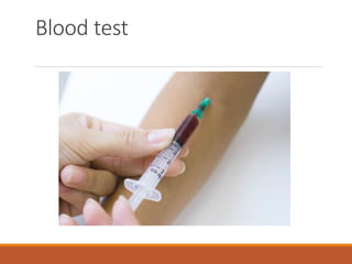 Blood test
 