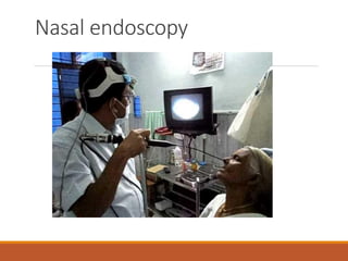 Nasal endoscopy
 