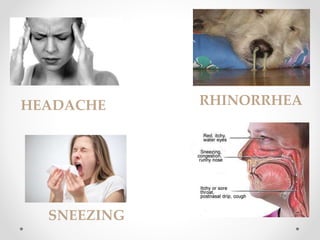 HEADACHE RHINORRHEA
SNEEZING
 