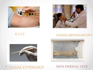 RAST
NASAL CYTOLOGY
NASOLARYNGOSCOPY
SKIN DERMAL TEST
 