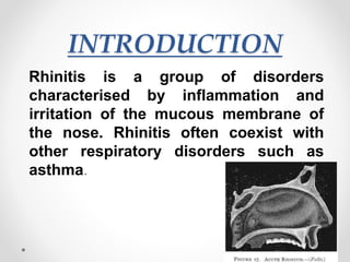 INTRODUCTION
Rhinitis is a group of disorders
characterised by inflammation and
irritation of the mucous membrane of
the nose. Rhinitis often coexist with
other respiratory disorders such as
asthma.
 