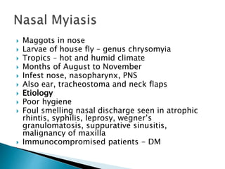 Rhinitis | PPTX