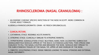 Bilateral Rhinitis Rhinitis.pptx