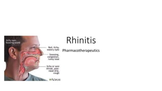 Rhinitis
Pharmacotherapeutics
 