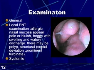 Examinaton General Local ENT examination :allergic nasal mucosa appear pale or bluish, boggy with swelling and watery discharge. there may be polyp, structural (septal deviation ,prominent turbinate). Systemic  