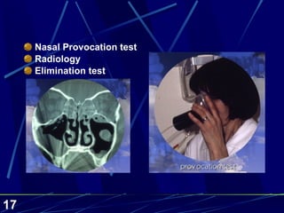 Nasal Provocation test Radiology Elimination test 