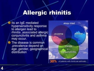 Allergic rhinitis Its an IgE mediated hypersensitivity response to allergen lead to rhinitis ,associated allergic conjunctivitis and asthma may occur. The disease is common ,prevalence depend on age ,gender, geographical distribution 