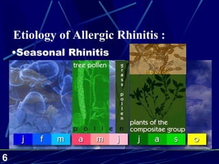 Seasonal Rhinitis Etiology of Allergic Rhinitis  : 