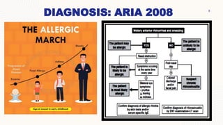 Aria Rhinitis rhinitis alergi rhinitis alergi rhinitis alergi | PPTX
