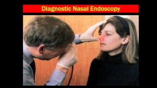 Rhinosinusitis- Definition, Clinical features, Diagnosis.pptx