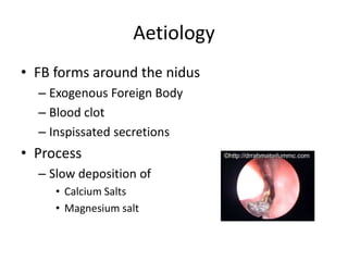 Rhinolith PPT