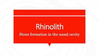 Rhinolith
Stone formation in the nasal cavity