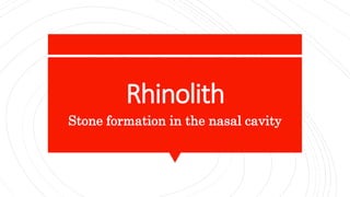 Rhinolith
Stone formation in the nasal cavity
 