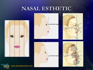 NASAL ESTHETIC www.clinicabenarroch.com 