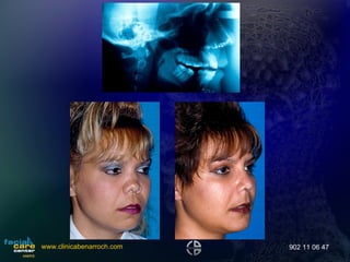 www.clinicabenarroch.com 902 11 06 47 