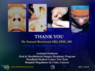 THANK YOU Dr. Samuel Benarroch MD, DDS, MS  Oral & Maxillofacial  Surgery Assistant Professor Oral & Maxillofacial Surgery Residency Program Woodhull Medical Center. New York Hospital Magallanes de Catia. Caracas www.clinicabenarroch.com 902 11 06 47 