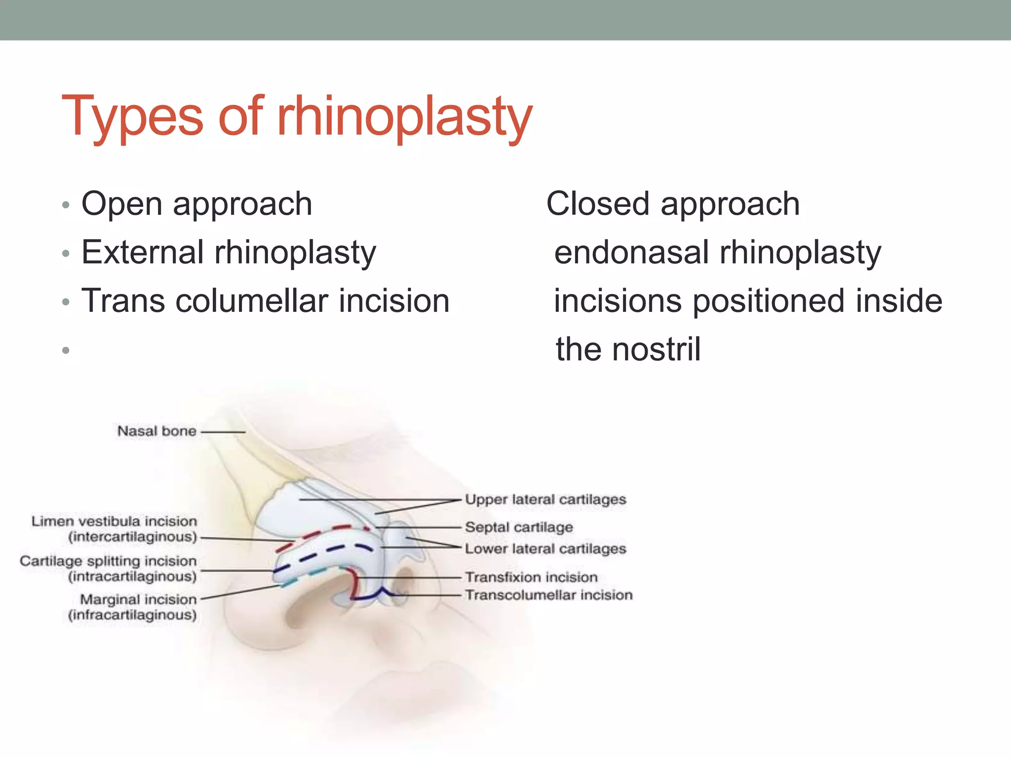 Transfixation Incision Rhinoplasty | PPTX