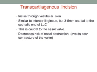 Transcartilagenous Incision
• Incise through vestibular skin
• Similar to intercartilaginous, but 3-5mm caudal to the
cephalic end of LLC
• This is caudal to the nasal valve
• Decreases risk of nasal obstruction (avoids scar
contracture of the valve)
 