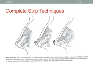 Complete Strip Techniques
1/27/2017 118
 
