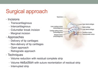 Surgical approach
• Incisions
• Transcartilaginous
• Intercartilaginous
• Columellar break incision
• Marginal incision
• Approaches
• Delivery of tip cartilages
• Non-delivery of tip cartilages
• Open approach
• Retrograde approach
• Techniques
• Volume reduction with residual complete strip
• Volume reduction with suture reorientation of residual strip
• Interrupted strip
 