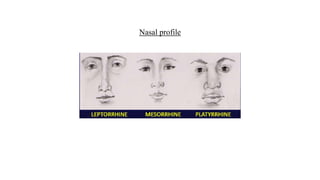 Nasal profile
 