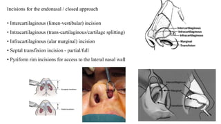 Incisions for the endonasal / closed approach
• Intercartilaginous (limen-vestibular) incision
• Intracartilaginous (trans-cartilaginous/cartilage splitting)
• Infracartilaginous (alar marginal) incision
• Septal transfixion incision - partial/full
• Pyriform rim incisions for access to the lateral nasal wall
 