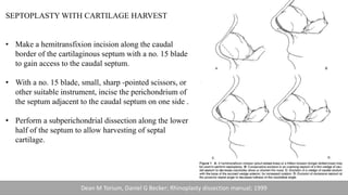 SEPTOPLASTY WITH CARTILAGE HARVEST
• Make a hemitransfixion incision along the caudal
border of the cartilaginous septum with a no. 15 blade
to gain access to the caudal septum.
• With a no. 15 blade, small, sharp -pointed scissors, or
other suitable instrument, incise the perichondrium of
the septum adjacent to the caudal septum on one side .
• Perform a subperichondrial dissection along the lower
half of the septum to allow harvesting of septal
cartilage.
Dean M Torium, Daniel G Becker; Rhinoplasty dissection manual; 1999
 
