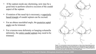 • If the septum needs any shortening, now may be a
good time to perform selective excision of the caudal
aspect of the septum
• If rotation of the nasal tip is necessary, a superiorly
based triangle of caudal septum can be excised.
• For an obtuse nasolabial angle, the posterior septal
angle can be trimmed .
• For a tension nose deformity or hanging-columella
deformity, the entire caudal septum may need to be
trimmed.
Dean M Torium, Daniel G Becker; Rhinoplasty dissection manual; 1999
 