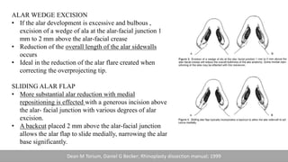 ALAR WEDGE EXCISION
• If the alar development is excessive and bulbous ,
excision of a wedge of ala at the alar-facial junction 1
mm to 2 mm above the alar-facial crease
• Reduction of the overall length of the alar sidewalls
occurs
• Ideal in the reduction of the alar flare created when
correcting the overprojecting tip.
SLIDING ALAR FLAP
• More substantial alar reduction with medial
repositioning is effected with a generous incision above
the alar- facial junction with various degrees of alar
excision.
• A backcut placed 2 mm above the alar-facial junction
allows the alar flap to slide medially, narrowing the alar
base significantly.
Dean M Torium, Daniel G Becker; Rhinoplasty dissection manual; 1999
 