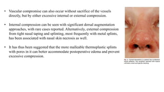 • Vascular compromise can also occur without sacrifice of the vessels
directly, but by either excessive internal or external compression.
• Internal compression can be seen with significant dorsal augmentation
approaches, with rare cases reported. Alternatively, external compression
from tight nasal taping and splinting, most frequently with metal splints,
has been associated with nasal skin necrosis as well.
• It has thus been suggested that the more malleable thermoplastic splints
with pores in it can better accommodate postoperative edema and prevent
excessive compression.
 