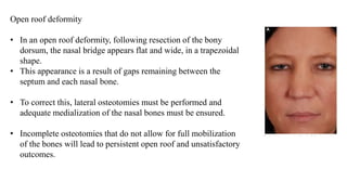 Open roof deformity
• In an open roof deformity, following resection of the bony
dorsum, the nasal bridge appears flat and wide, in a trapezoidal
shape.
• This appearance is a result of gaps remaining between the
septum and each nasal bone.
• To correct this, lateral osteotomies must be performed and
adequate medialization of the nasal bones must be ensured.
• Incomplete osteotomies that do not allow for full mobilization
of the bones will lead to persistent open roof and unsatisfactory
outcomes.
 