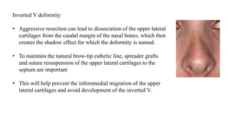 Inverted V deformity
• Aggressive resection can lead to dissociation of the upper lateral
cartilages from the caudal margin of the nasal bones, which then
creates the shadow effect for which the deformity is named.
• To maintain the natural brow-tip esthetic line, spreader grafts
and suture resuspension of the upper lateral cartilages to the
septum are important
• This will help prevent the inferomedial migration of the upper
lateral cartilages and avoid development of the inverted V.
 