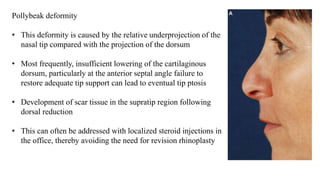 Pollybeak deformity
• This deformity is caused by the relative underprojection of the
nasal tip compared with the projection of the dorsum
• Most frequently, insufficient lowering of the cartilaginous
dorsum, particularly at the anterior septal angle failure to
restore adequate tip support can lead to eventual tip ptosis
• Development of scar tissue in the supratip region following
dorsal reduction
• This can often be addressed with localized steroid injections in
the office, thereby avoiding the need for revision rhinoplasty
 