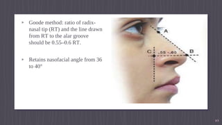 Rhinoplasty oral and maxillofacial surgery | PPTX