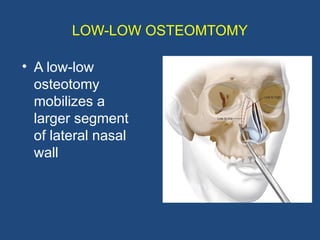 RHINOPLASTY ,Types of incision & Osteotomies.pptx
