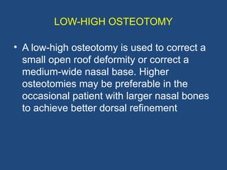 RHINOPLASTY ,Types of incision & Osteotomies.pptx